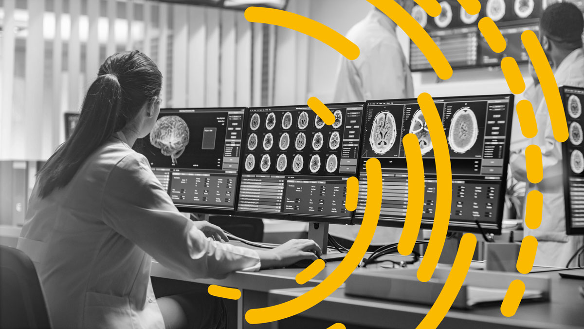 Doctor reviewing brain scans with a fast network bandwidth using Statseeker